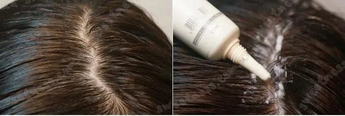 Lador Scalp Scaling Spa Hair Ampoule 4x15g