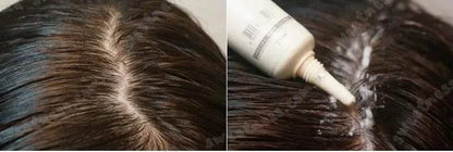 Lador Scalp Scaling Spa Hair Ampoule 4x15g